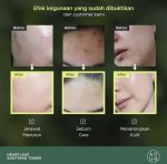 تونر آنوا Anua 77% تسکین دهنده - Image 5